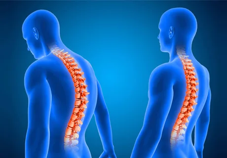 Postural-Correction