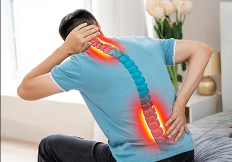 Spondylosis