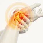 Tunnel-Syndrome